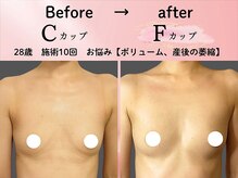 ロットプラス(Lot Plus)の雰囲気（細見な方もしっかりバストアップ。産後のお悩みもお任せください）
