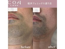 コアラッシュ 福井フェニックス通り店(COA LASH)