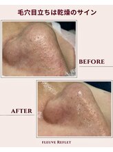 フルーヴ ルフレ(Fleuve Reflet)/肌が冷えると、毛穴も固まる！