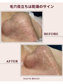 フルーヴ ルフレ(Fleuve Reflet)/肌が冷えると、毛穴も固まる！