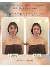 エステティックシトラス(esthetic CITRUS)/before & after