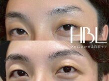 エクラ(Eclat)/HBL/ハリウッドブロウリフト