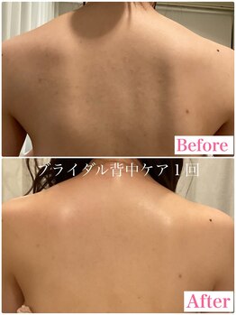 トータルビューティーサロン 凛/自分で見えない背中