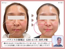 グレースエール トータルビューティーサロン(Grace Aile)の雰囲気（臨床試験済みの高い技術で骨格から作り出す自然な小顔＊）