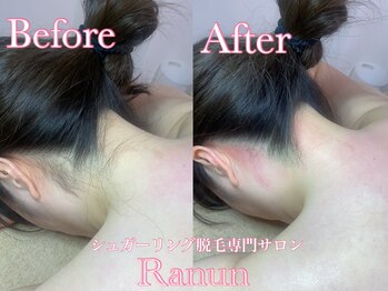 ラナン(Ranun)/1回目から目に見える減耗効果