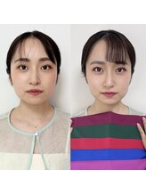 サロン ルシール(Salon lucir)/Before&After