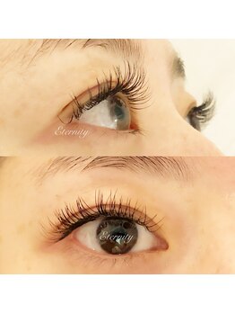 エタニティ(eternity)/フラットラッシュ