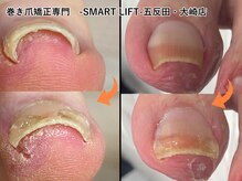 スマートリフト 五反田 大崎店(SMART LIFT)