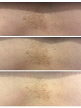 クリスタルビューティ 渋谷/【セラピールボディ】