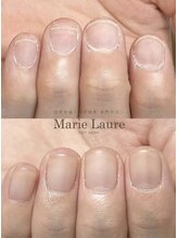 マリーロール 天王寺店(Marie Laure)/自爪育成/深爪矯正/ネイルケア