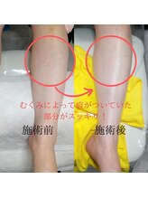 ドクターネイル爪革命 長野店/【トータルフットケア】/フット