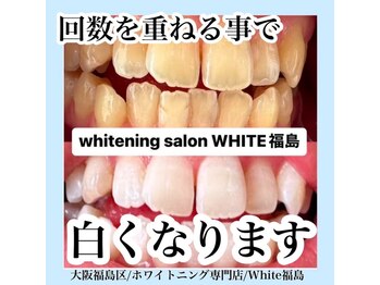 ホワイトニングサロン ホワイト(WHITE)/