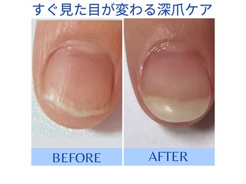シュアム(shuam)