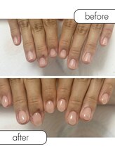 ピノ(pino)/◆深爪矯正＋自爪風仕上げ◆
