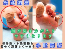 ドクターネイル爪革命 長野店の雰囲気（母趾の歪みで困っている方は多く歩き方の改善につながる矯正です）