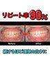 リピート率90%◎セルフホワイトニング30分　¥5,000→¥3,500