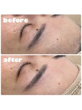 ラクシー 船橋(luxssy)/お顔シェービング×眉毛wax