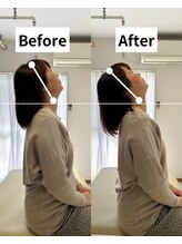 Root整体院【首・肩こり/腰痛/根本改善】/首こりBefore/After