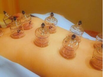 杏林整体院 池袋院/吸い玉(カッピング)は何に?