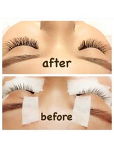 アイトレンド 澄川店(EYETREND)/BEFORーAFTER