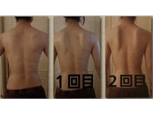 リュミエール デスポワール(Lumiere d'espoir)/ハーブピーリング