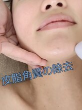 マヴィ 香里園店(MavY.)/ノンニードル水光注入の秘密