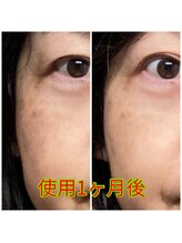 ノウ(nou)/NMN美容液