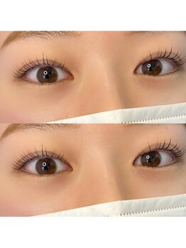 イル 鎌倉(ile)/似合わせラッシュリフト