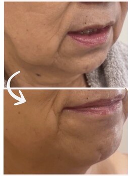 サロンドカメリア(salon de Camellia)/エエクソソームでエイジングケア