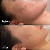 リモアボーテ(RIMOA beaute)