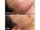 リモアボーテ(RIMOA beaute)の写真