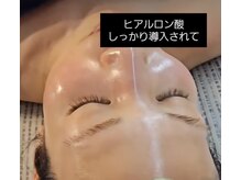 ミヨン(Miyong)/お肌の変化を実感