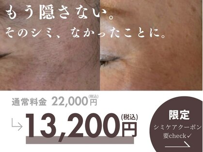 グランデヴァレ(Grande Vallee)の写真