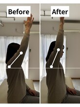 Root整体院【首・肩こり/腰痛/根本改善】/肩こりBefore/After