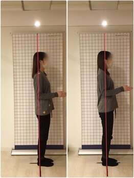 越谷KAJI整体院/腰痛