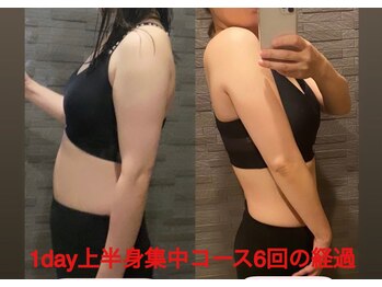 ちゅるん肌ドットコム 心斎橋店(ちゅるん肌.com)/上半身集中6回の変化