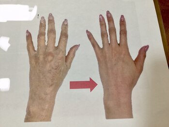 トゥービー(To Be)/