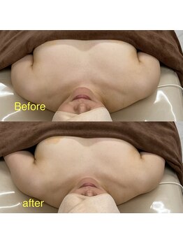 ベッピン(Beppin)/1回結果/バストアップ/静岡茶町