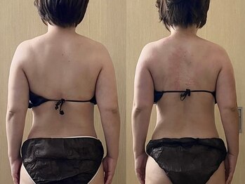 マイティー整骨院 ココア(CoCoa)/活性リンパ洗浄