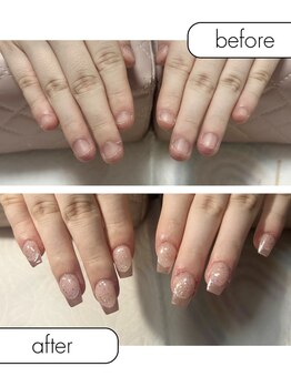 ピノ(pino)/◆深爪矯正＋長さだしアート◆