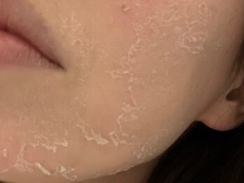 ディアナ 代々木上原(_Diana)/グリーンピール/Diana代々木上原