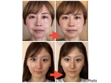 十六夜マッサージの雰囲気（シナプス療法で目の疲れやお顔むくみを改善すると目力upや小顔に）