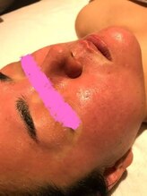 エリール(elire)/核酸DNA美容法