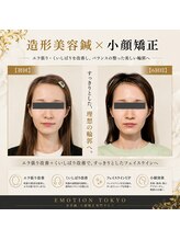 エモシオン トウキョウ(EMOTION TOKYO)/造形美容鍼×小顔矯正