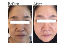 ジェニックサロン グランドギンザ ひたちなか(GENIC SALON GRAND GINZA)/ 日本一の肌改善サロンの実力