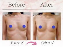 エムエムエム 表参道Luxeサロン(M.M.M)/【バストアップ例】　B→Cカップ