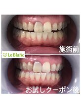 ルブラン 奈良店(Le Blanc)/最近の男性は