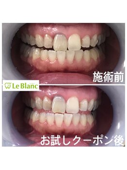 ルブラン 奈良店(Le Blanc)/最近の男性は