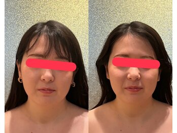 ムスビ(Musubi)/左右差を整えて小顔矯正!