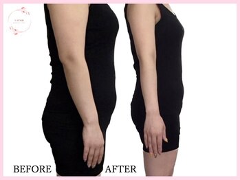 カパリリ/耳つぼ施術☆名古屋/痩身